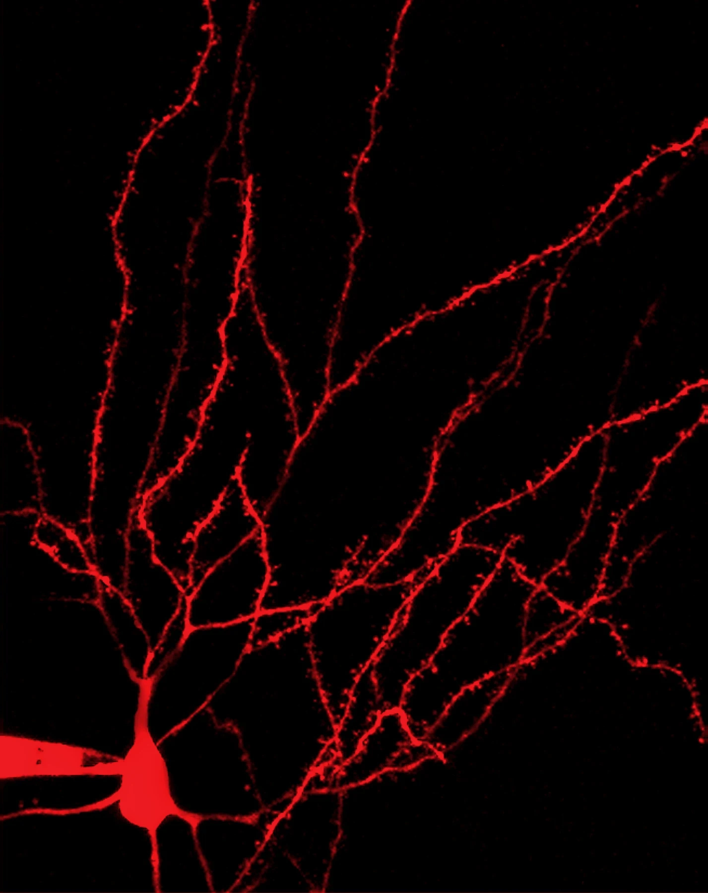 Red fluorescent striatal projection neuron