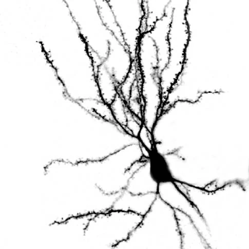Reconstructed striatal projection neuron showing dendritic arborization and spines