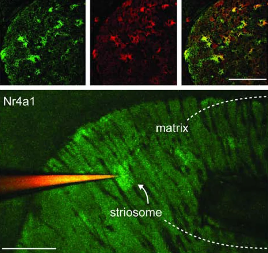 Fluorescence microscopy figure showing striosome and matrix compartments